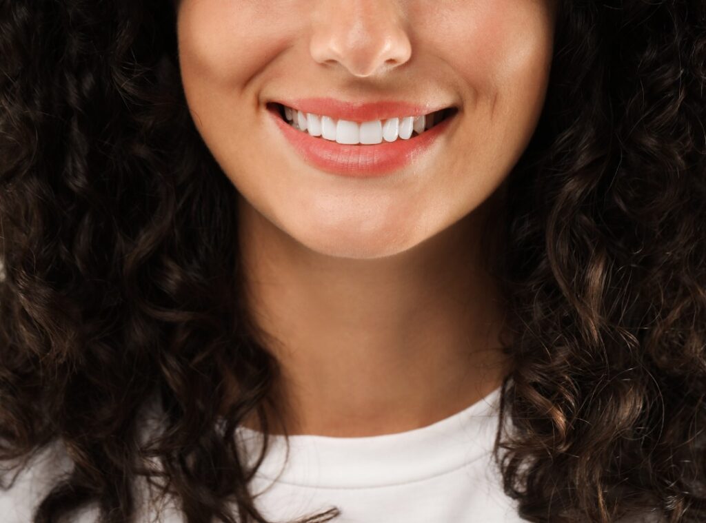 Feldspathic veneer treatment at Afyon Ballıpınar Dental Clinic – thin porcelain dental veneers for a natural look and aesthetic smile.