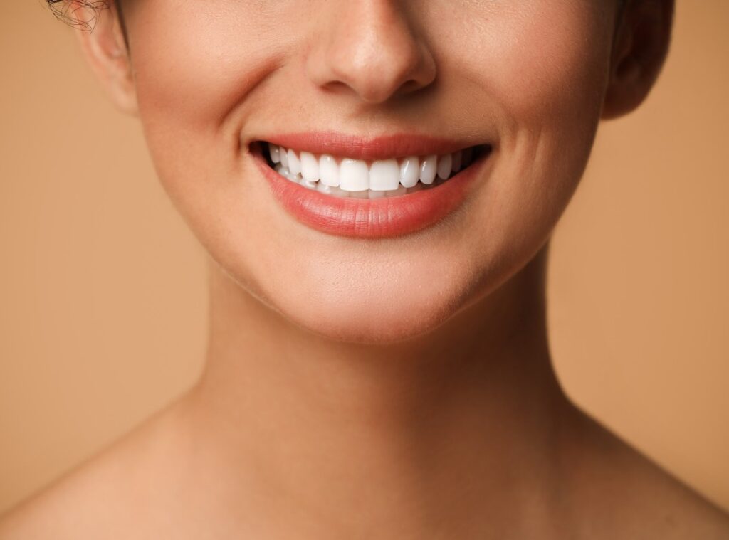 Laminate veneer treatment at Afyon Ballıpınar Dental Clinic – porcelain laminates for an aesthetic and natural smile.