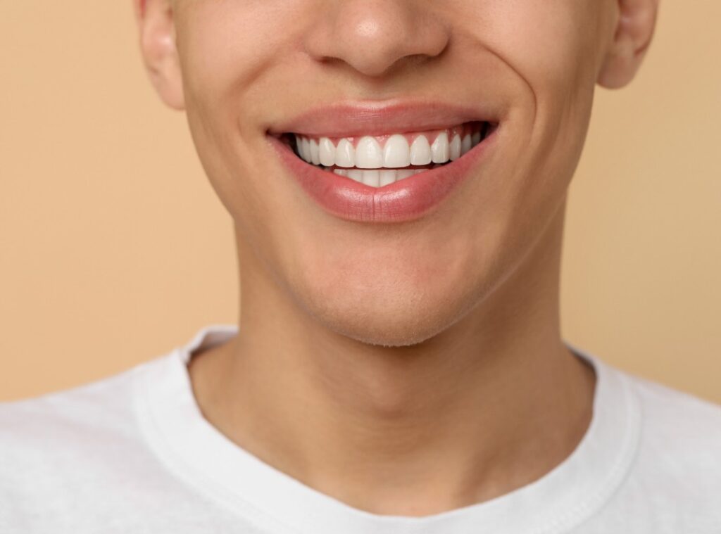 Zirconium veneer treatment at Afyon Ballıpınar Dental Clinic – modern and aesthetic dental veneer solution for durable and natural-looking teeth.